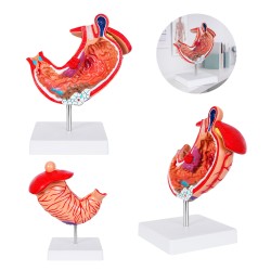 Modelo Anatómico Gastro | Personalizado con tu Logo